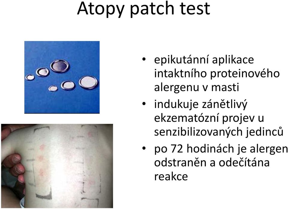 ekzematózní projev u senzibilizovaných jedinců po