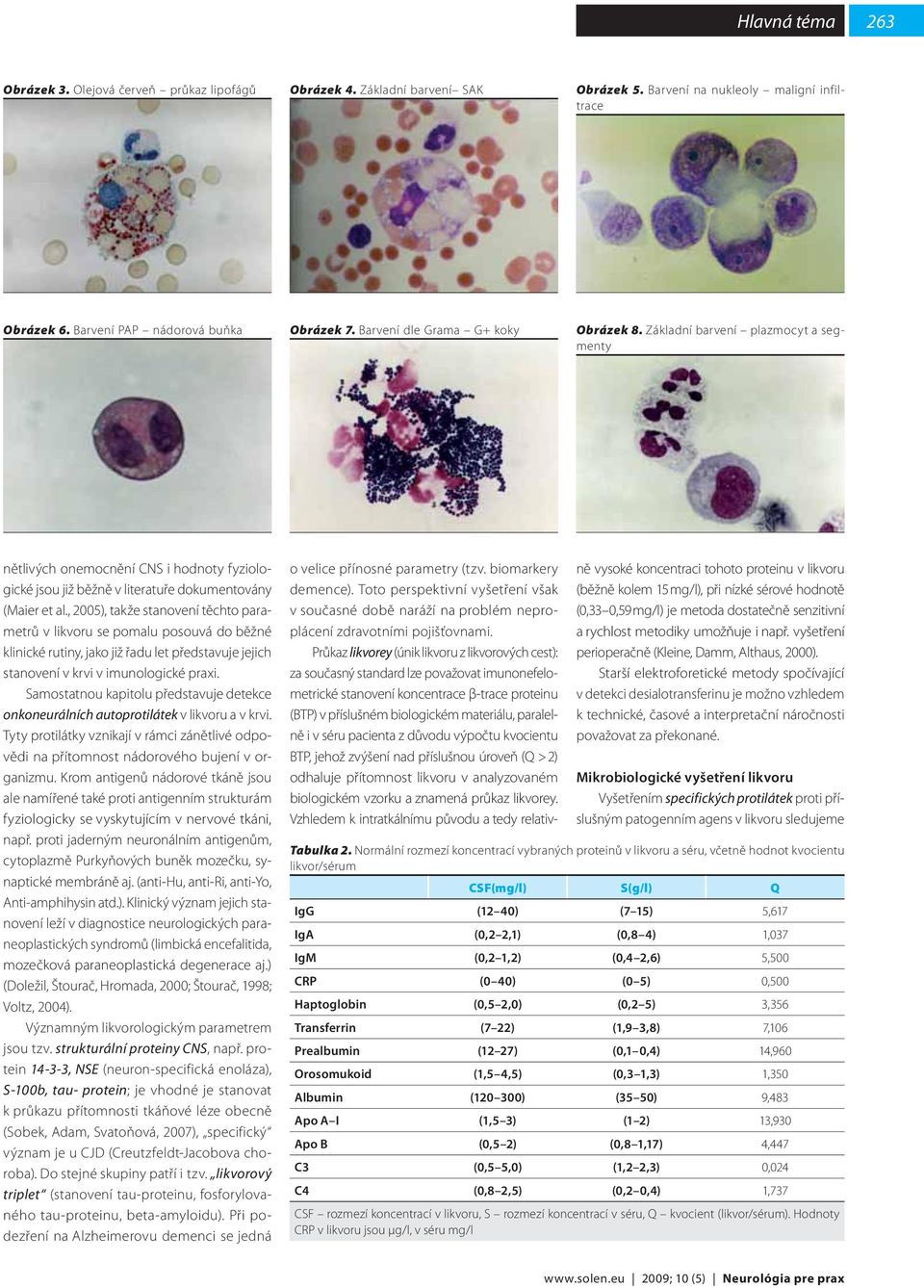 , 2005), takže stanovení těchto parametrů v likvoru se pomalu posouvá do běžné klinické rutiny, jako již řadu let představuje jejich stanovení v krvi v imunologické praxi.