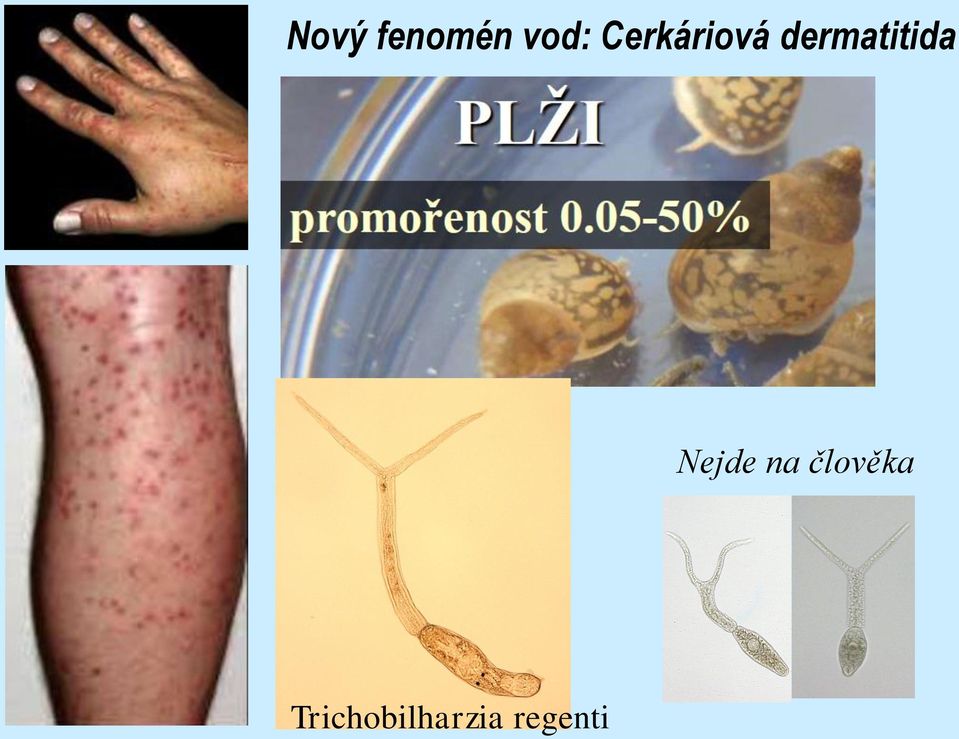 dermatitida Nejde na