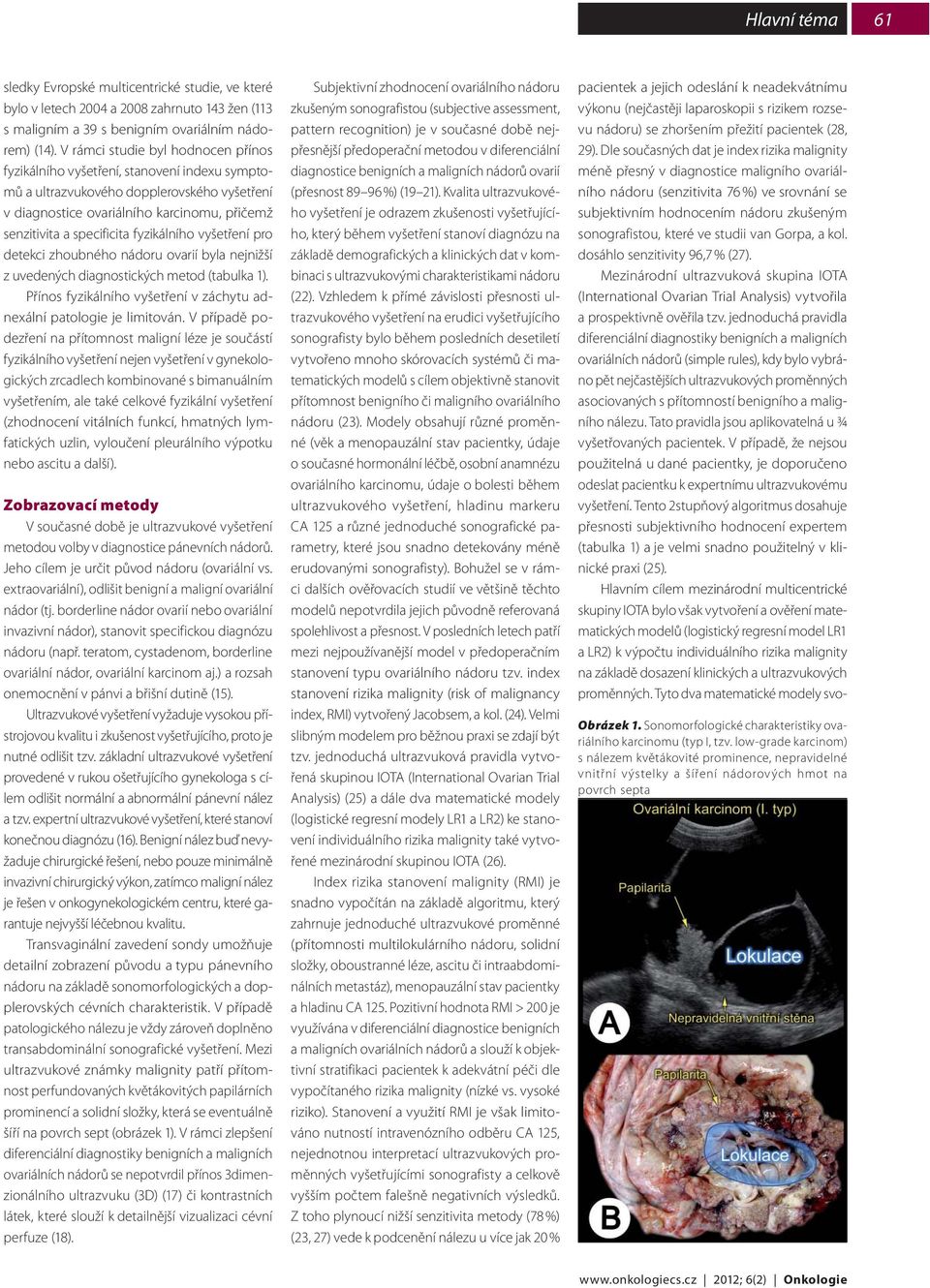 fyzikálního vyšetření pro detekci zhoubného nádoru ovarií byla nejnižší z uvedených diagnostických metod (tabulka 1). Přínos fyzikálního vyšetření v záchytu adnexální patologie je limitován.