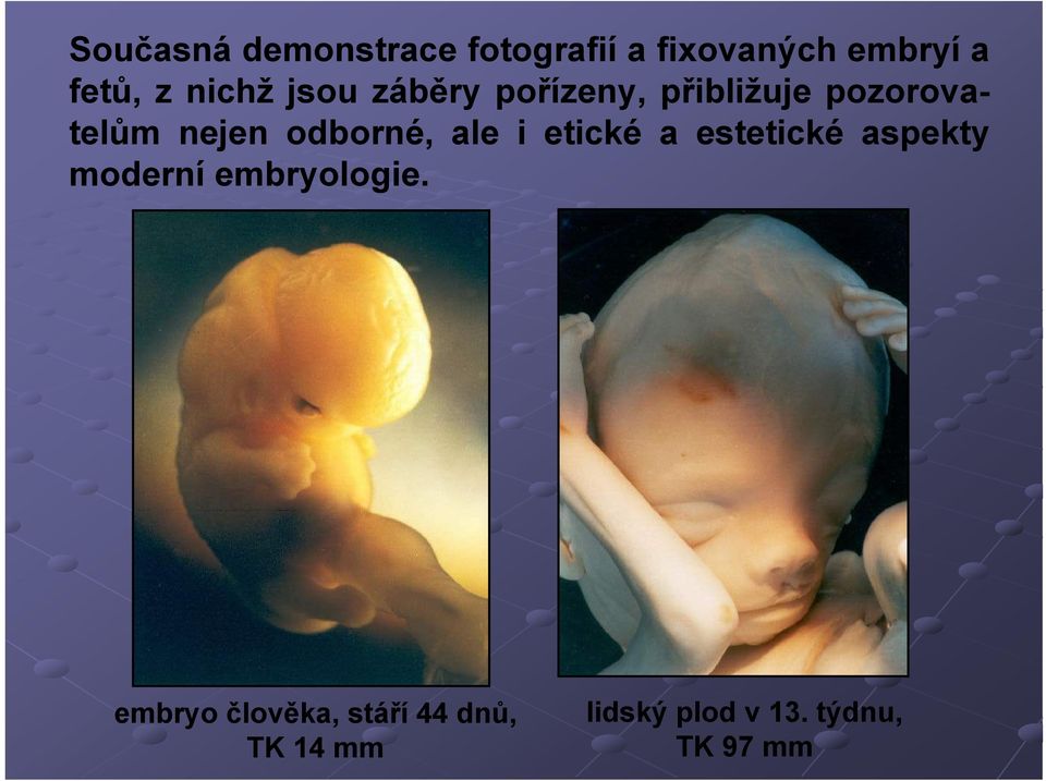 odborné, ale i etické a estetické aspekty moderní embryologie.