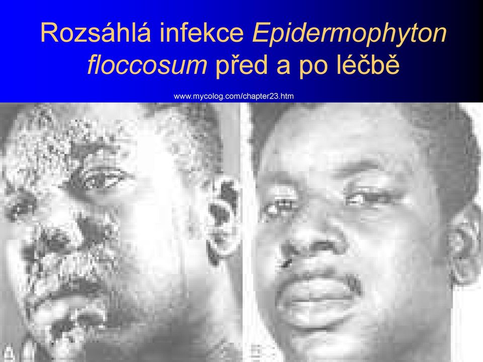 floccosum před a po