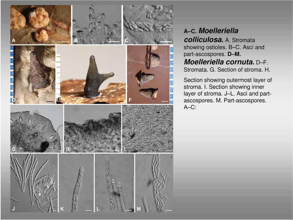 Section of stroma. H. Section showing outermost layer of stroma. I.