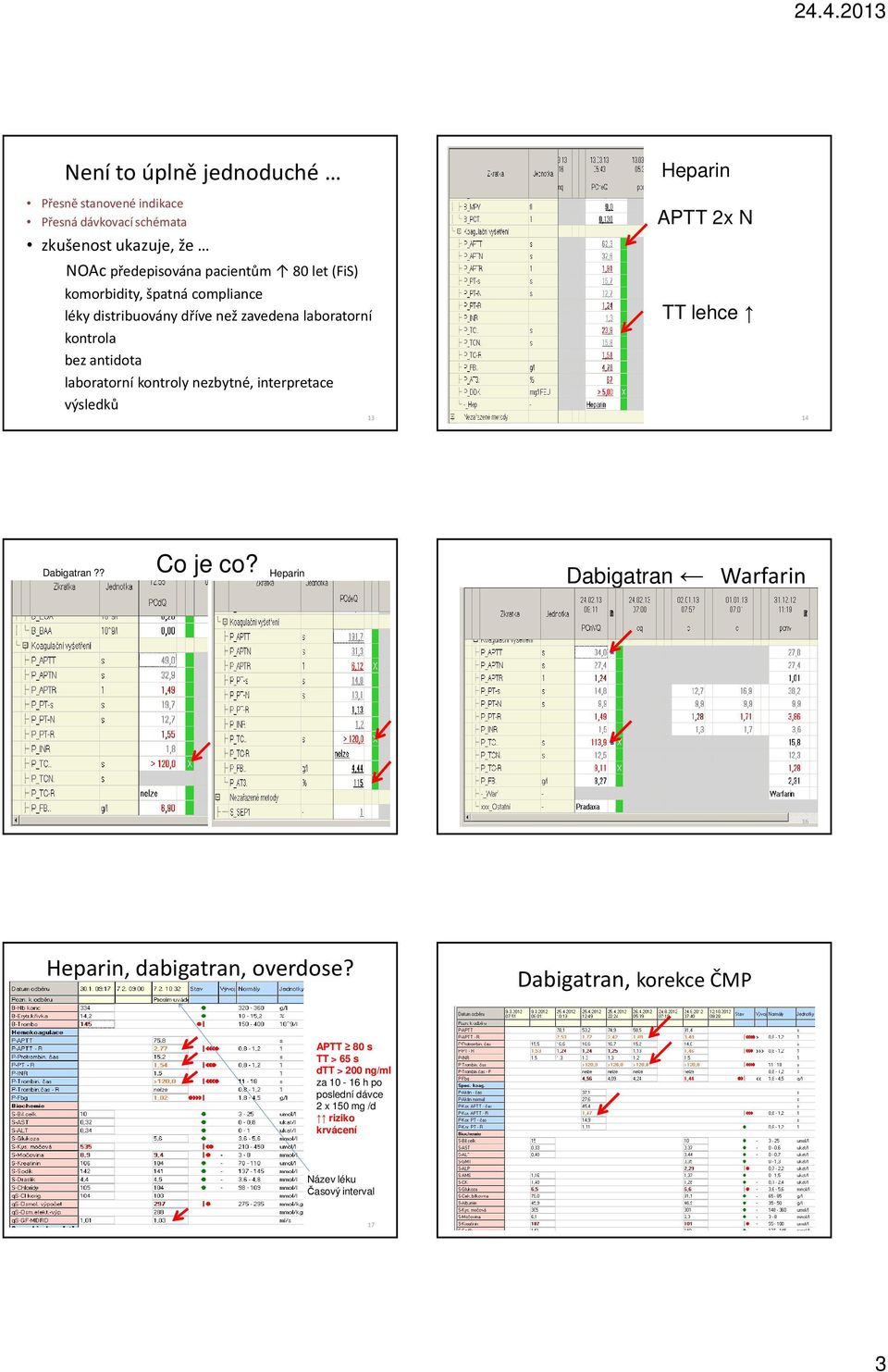 interpretace výsledků APTT 2x N TT lehce 13 14 Dabigatran?? Co je co? Heparin Dabigatran Warfarin 15 16 Heparin, dabigatran, overdose?