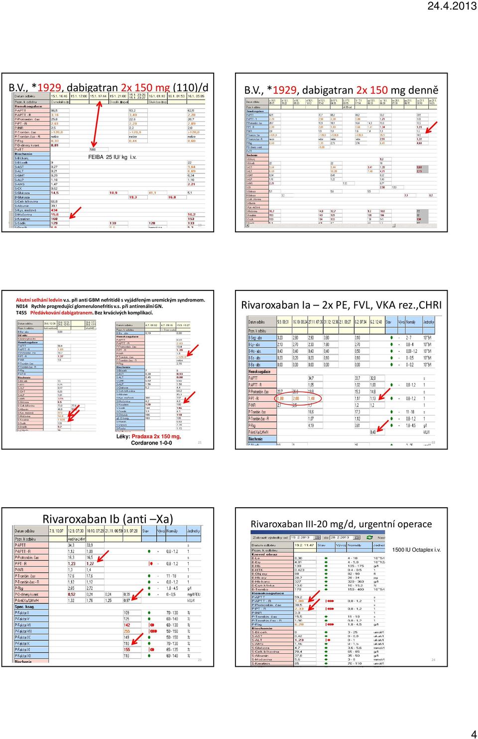 N014 Rychle progredující glomerulonefritis v.s. při antirenální GN. T455 Předávkování dabigatranem. Bez krvácivých komplikací.