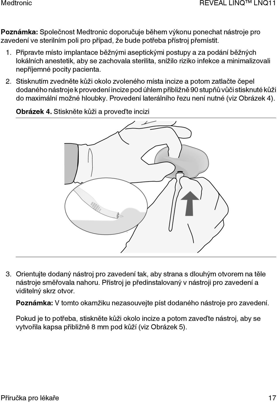 Stisknutím zvedněte kůži okolo zvoleného místa incize a potom zatlačte čepel dodaného nástroje k provedení incize pod úhlem přibližně 90 stupňů vůči stisknuté kůži do maximální možné hloubky.