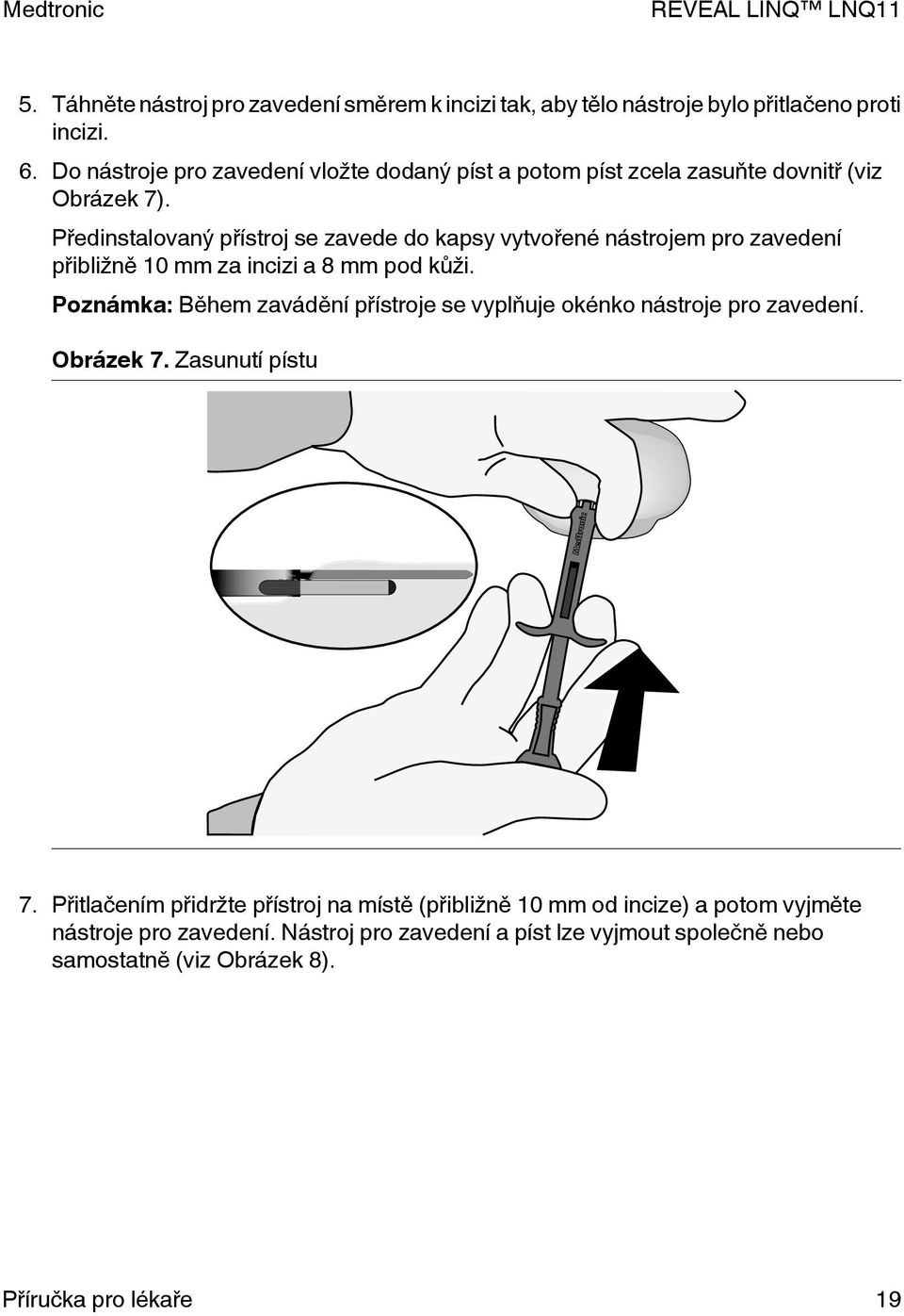 Předinstalovaný přístroj se zavede do kapsy vytvořené nástrojem pro zavedení přibližně 10 mm za incizi a 8 mm pod kůži.