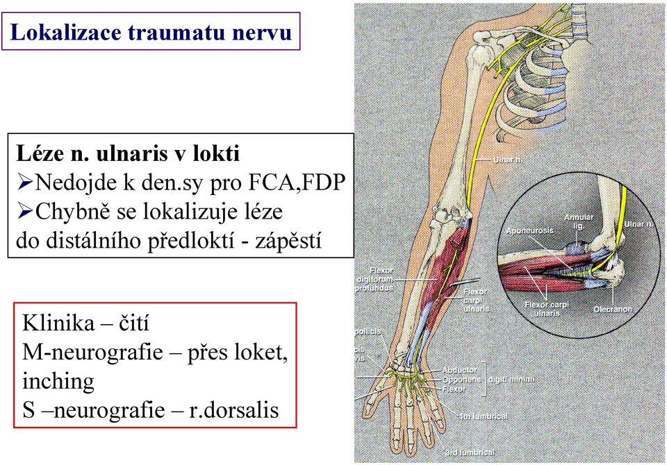 sy pro FCA,FDP Chybně se lokalizuje léze do