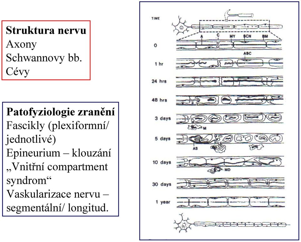 (plexiformní/ jednotlivé) Epineurium klouzání