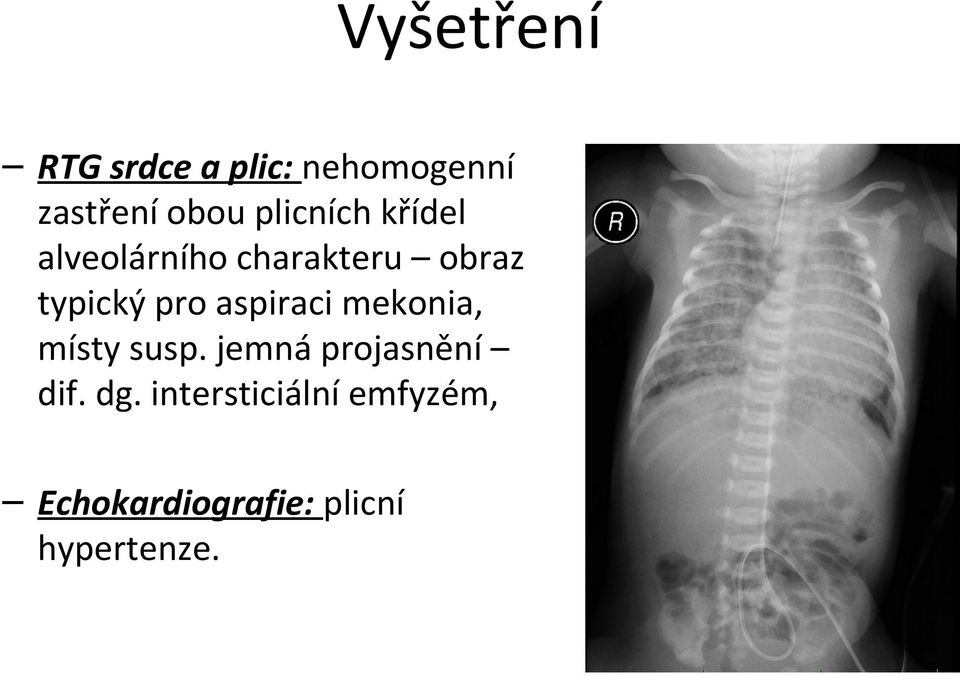 pro aspiraci mekonia, místy susp. jemná projasnění dif.