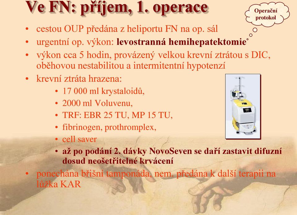 hypotenzí krevní ztráta hrazena: 17 000 ml krystaloidů, 2000 ml Voluvenu, TRF: EBR 25 TU, MP 15 TU, fibrinogen, prothromplex, cell