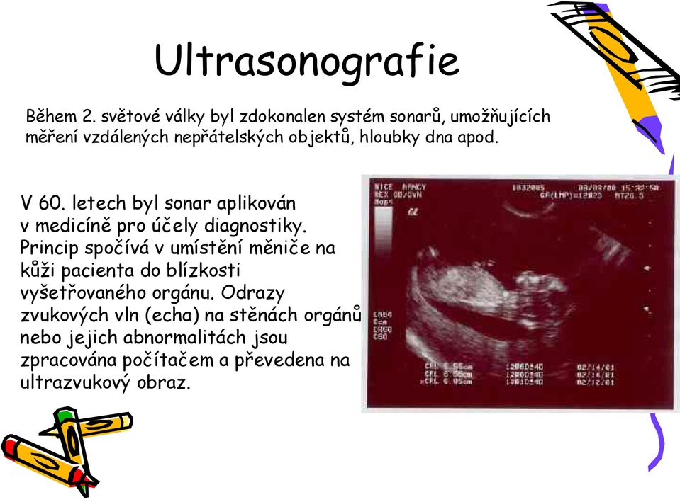 dna apod. V 60. letech byl sonar aplikován v medicíně pro účely diagnostiky.