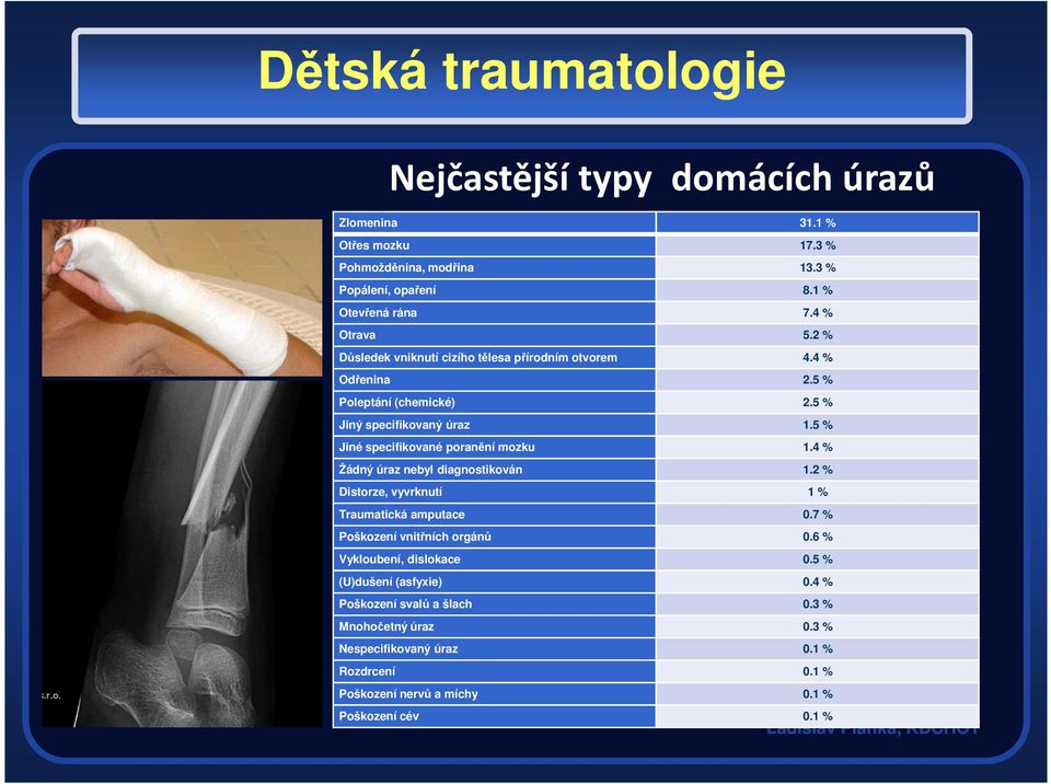 5 % Jiné specifikované poranění mozku 1.4 % Žádný úraz nebyl diagnostikován 1.2 % Distorze, vyvrknutí 1 % Traumatická amputace 0.7 % Poškození vnitřních orgánů 0.