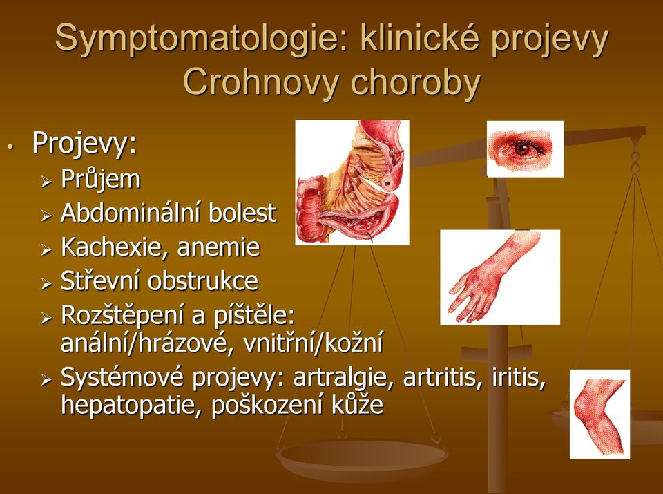 Rozštěpení a píštěle: anální/hrázové, vnitřní/kožní Systémové