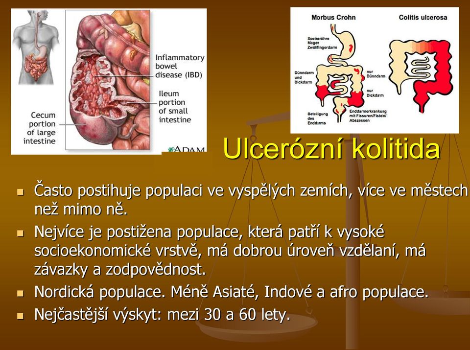 Nejvíce je postižena populace, která patří k vysoké socioekonomické vrstvě, má