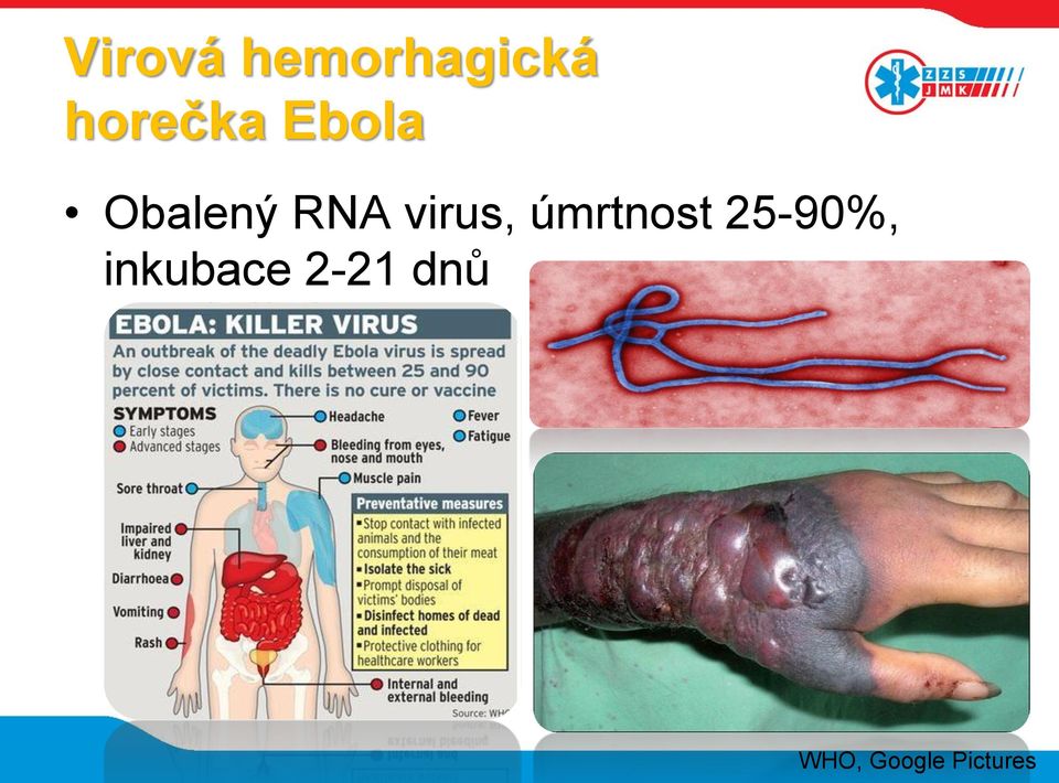 virus, úmrtnost 25-90%,