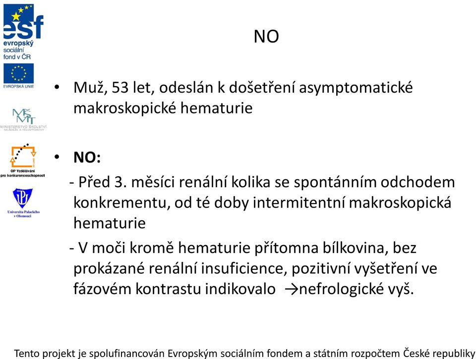 makroskopická hematurie - V moči kromě hematurie přítomna bílkovina, bez prokázané