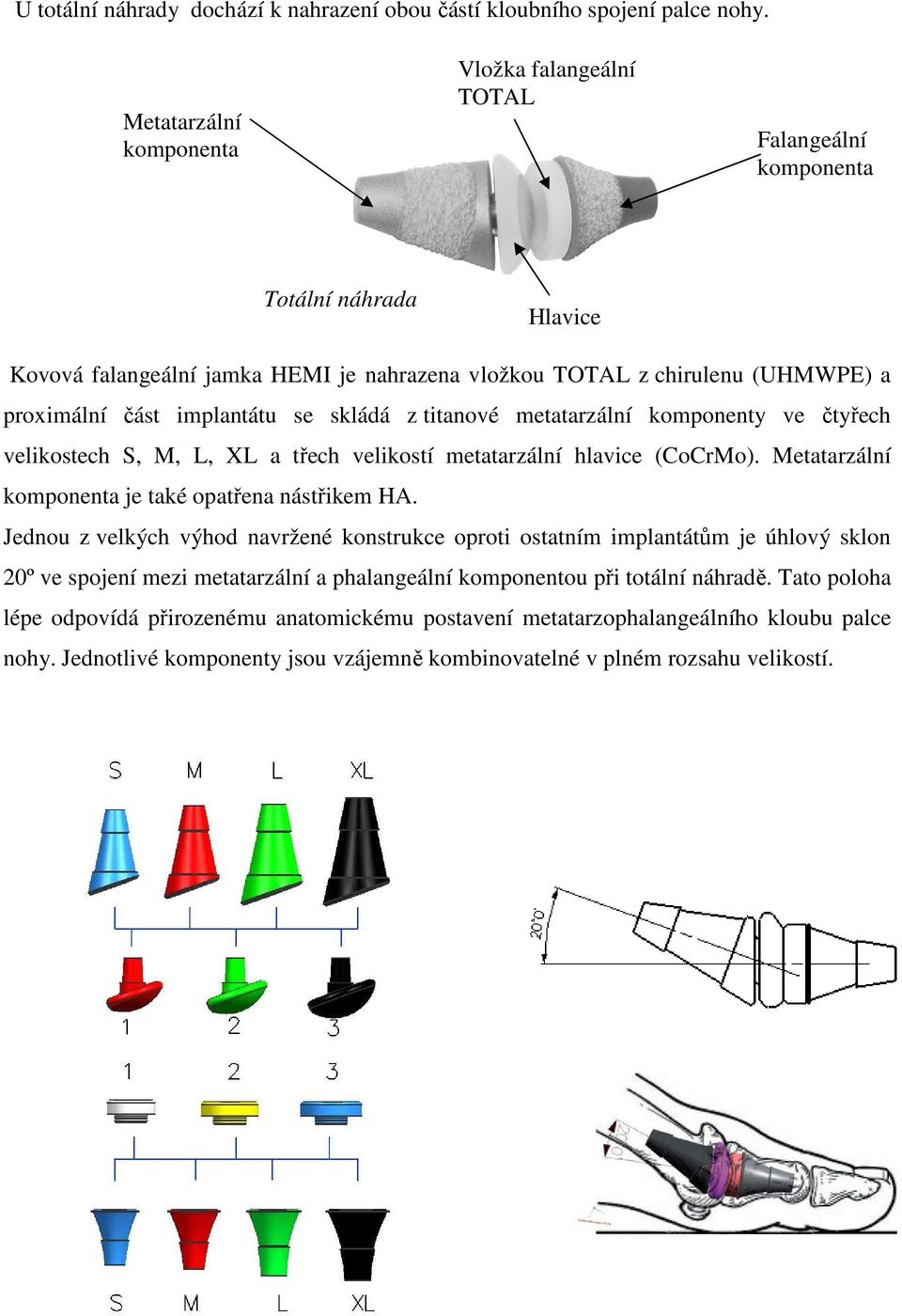 implantátu se skládá z titanové metatarzální komponenty ve čtyřech velikostech S, M, L, XL a třech velikostí metatarzální hlavice (CoCrMo). Metatarzální komponenta je také opatřena nástřikem HA.