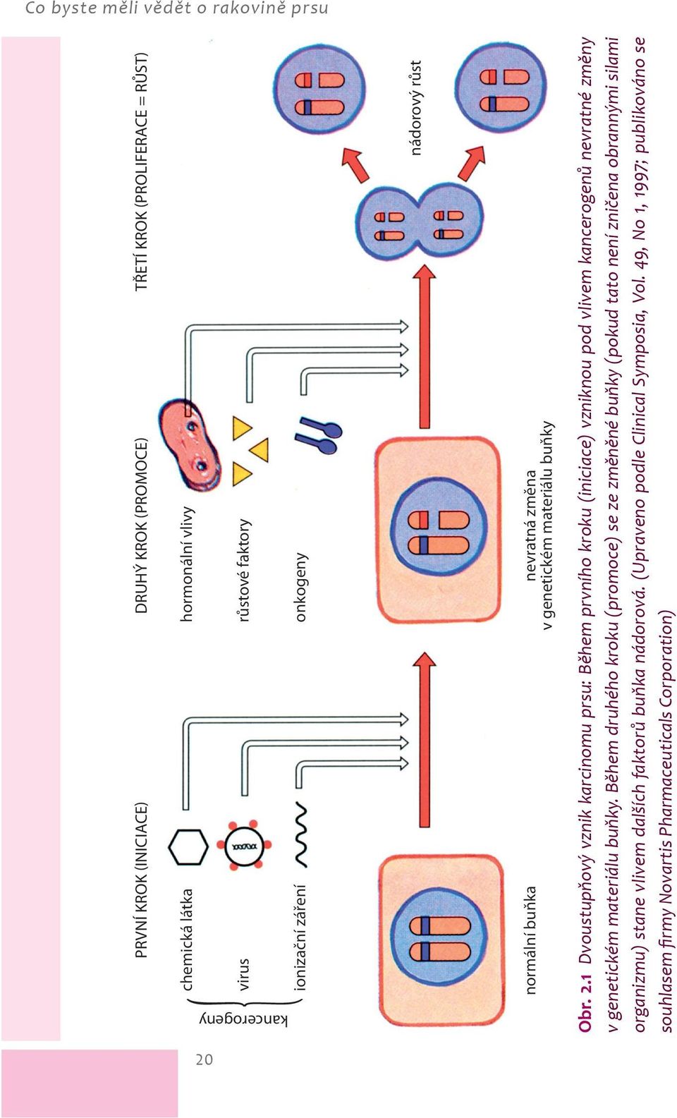 1 Dvoustupňový vznik karcinomu prsu: Během prvního kroku (iniciace) vzniknou pod vlivem kancerogenů nevratné změny v genetickém materiálu buňky.