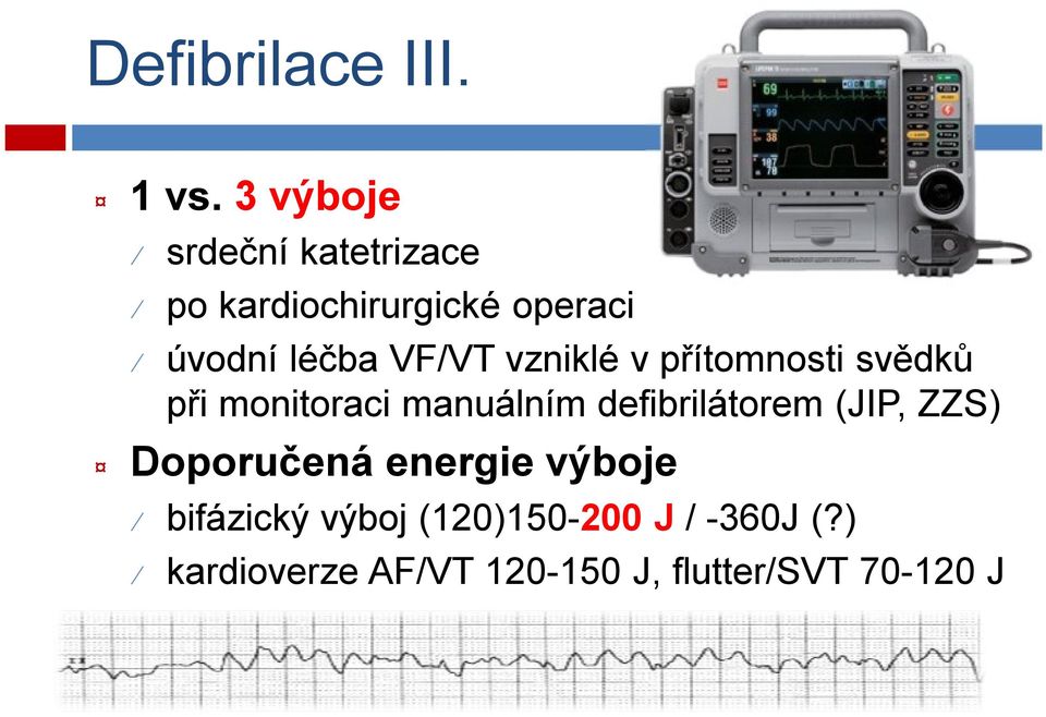 VF/VT vzniklé v přítomnosti svědků při monitoraci manuálním defibrilátorem