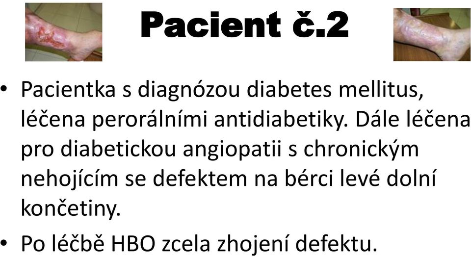 perorálními antidiabetiky.