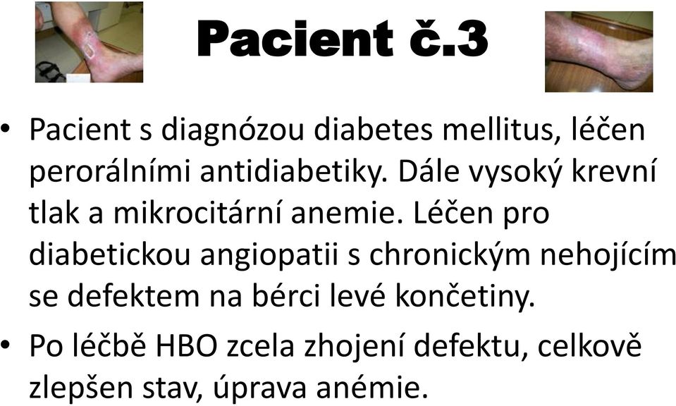 Dále vysoký krevní tlak a mikrocitární anemie.