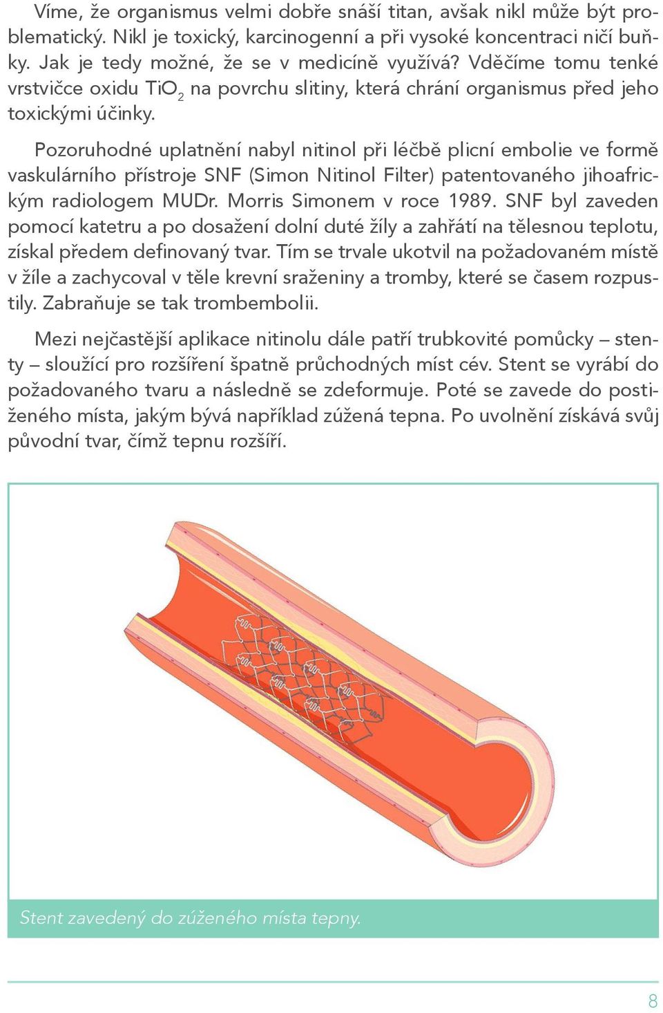 Pozoruhodné uplatnění nabyl nitinol při léčbě plicní embolie ve formě vaskulárního přístroje SNF (Simon Nitinol Filter) patentovaného jihoafrickým radiologem MUDr. Morris Simonem v roce 1989.