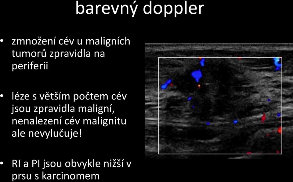 jsou zpravidla maligní, nenalezení cév malignitu