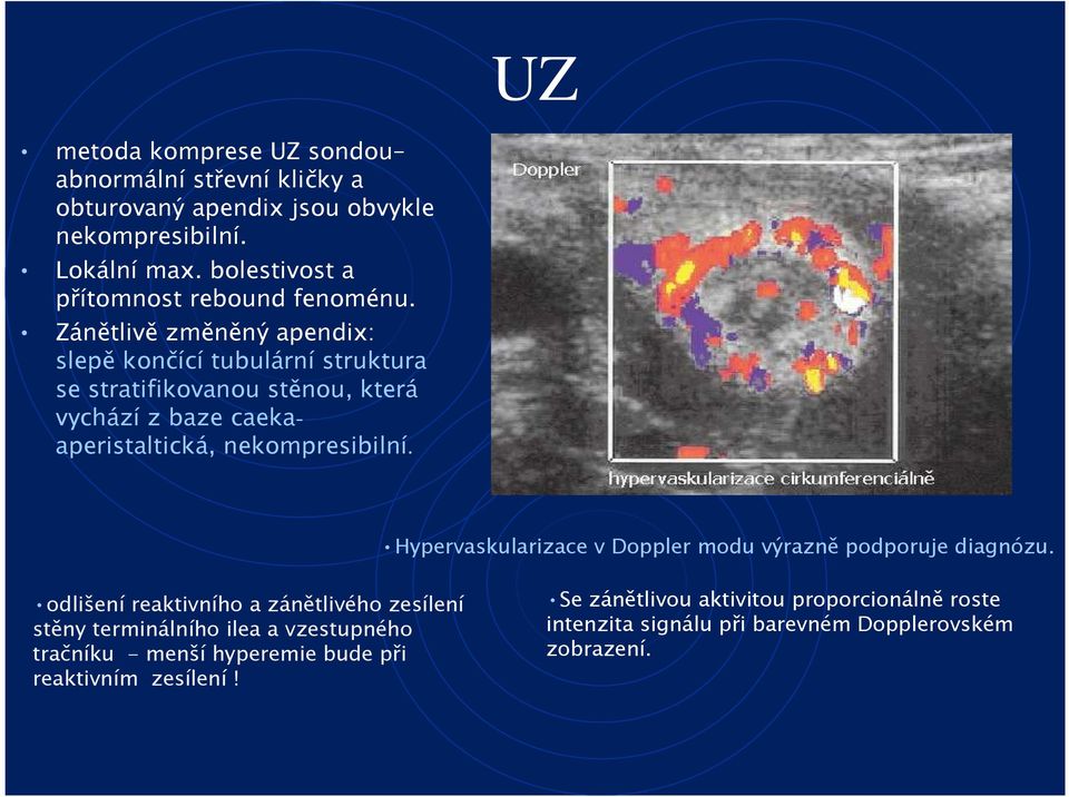 Zánětlivě změněný apendix: slepě končící tubulární struktura se stratifikovanou stěnou, která vychází z baze caekaaperistaltická, nekompresibilní.