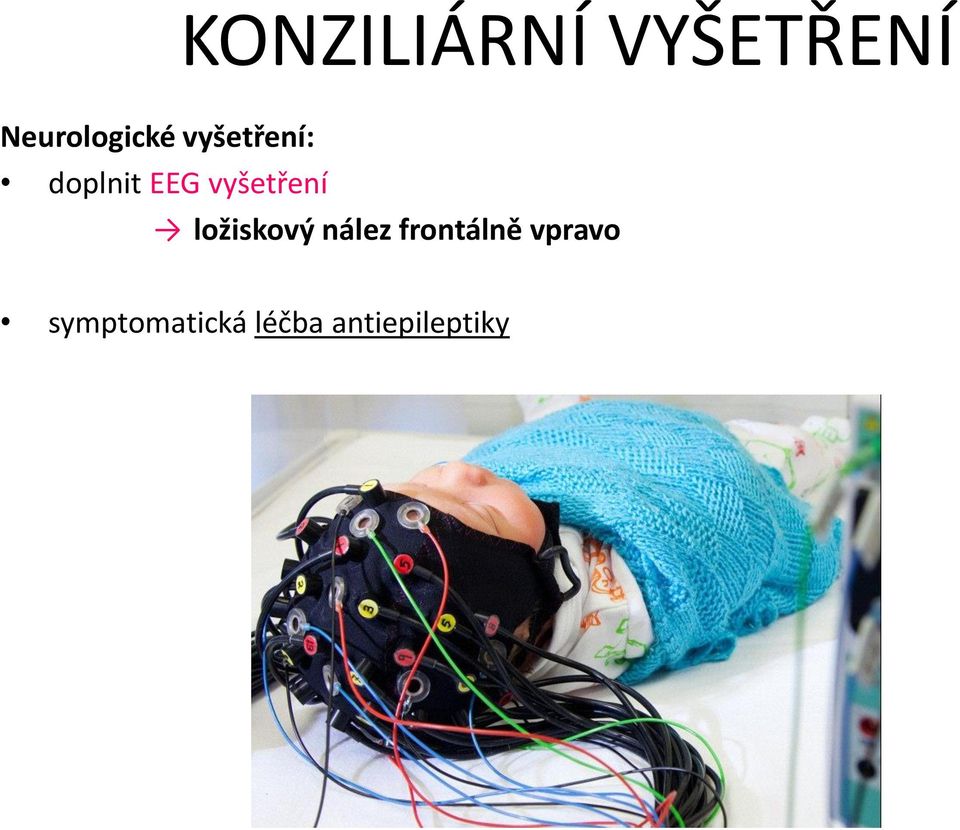 EEG vyšetření ložiskový nález