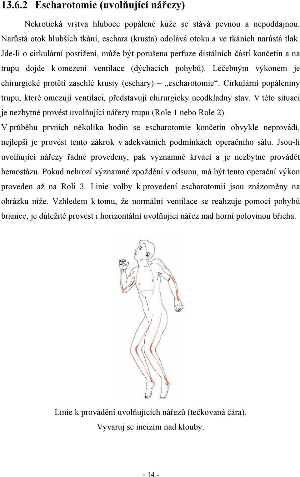 Léčebným výkonem je chirurgické protětí zaschlé krusty (eschary) escharotomie. Cirkulární popáleniny trupu, které omezují ventilaci, představují chirurgicky neodkladný stav.