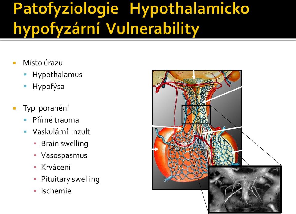 swelling Ischemie Long hypophyseal portal veins Anterior pituitary Short