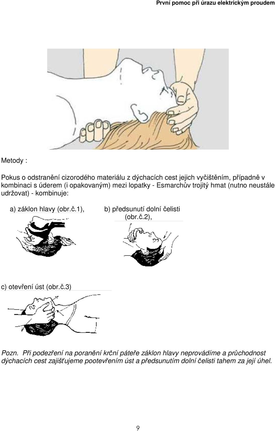 1), b) předsunutí dolní čelisti (obr.č.2), c) otevření úst (obr.č.3) Pozn.