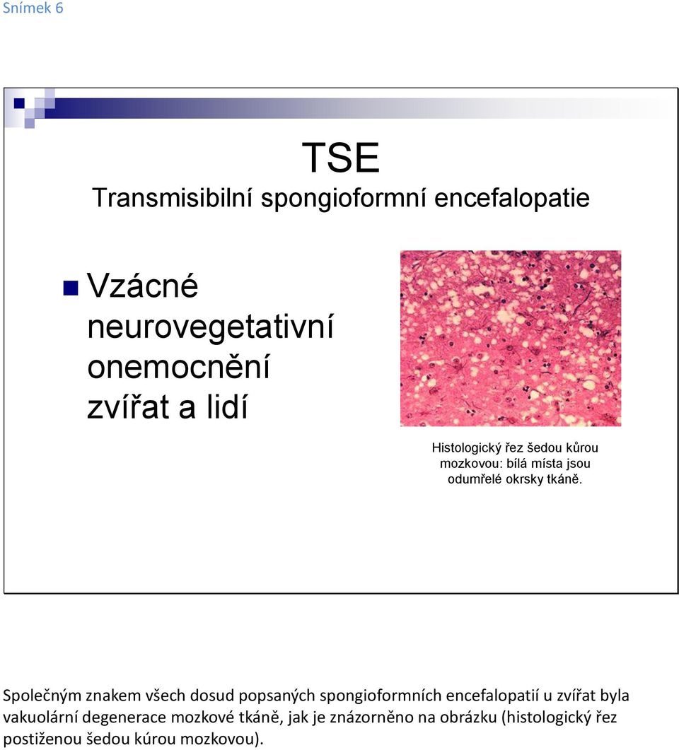 Společným znakem všech dosud popsaných spongioformních encefalopatií u zvířat byla vakuolární