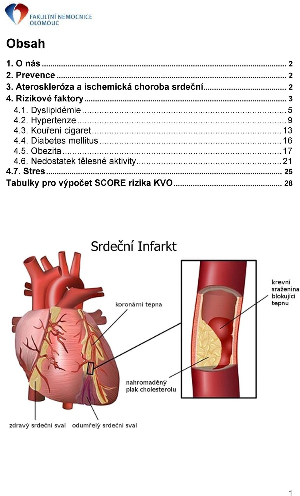 .. 13 4.4. Diabetes mellitus... 16 4.5. Obezita... 17 4.6. Nedostatek tělesné aktivity.