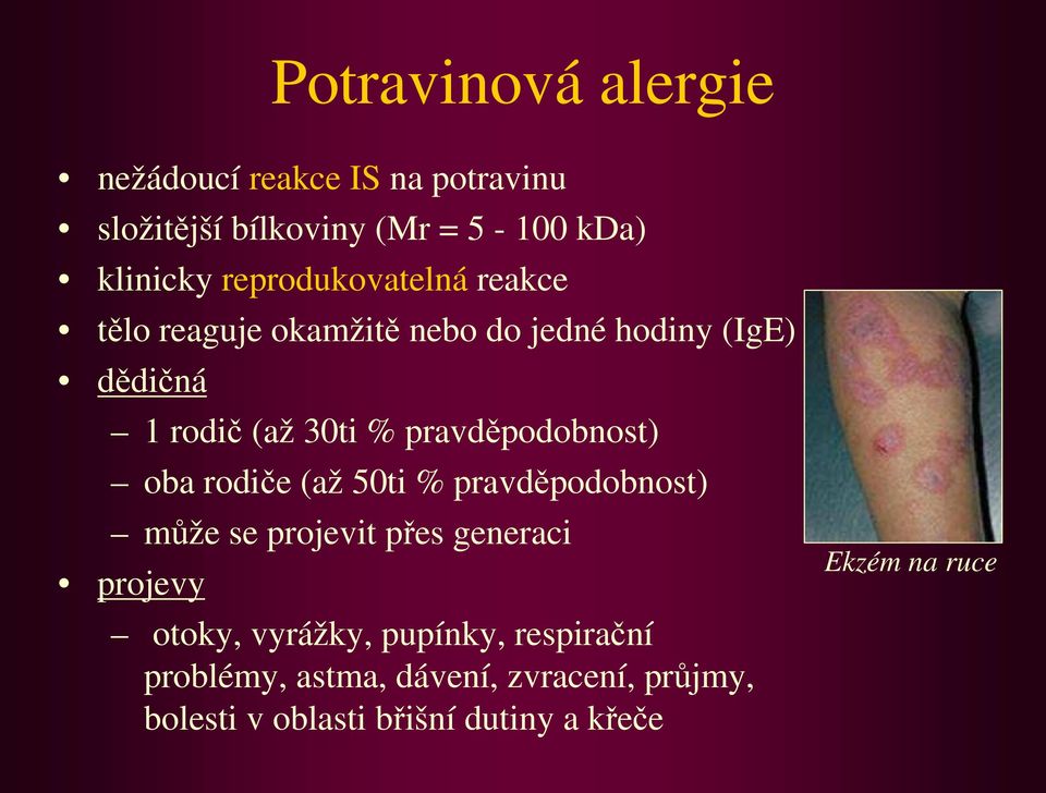 pravděpodobnost) oba rodiče (až 50ti % pravděpodobnost) může se projevit přes generaci projevy otoky,