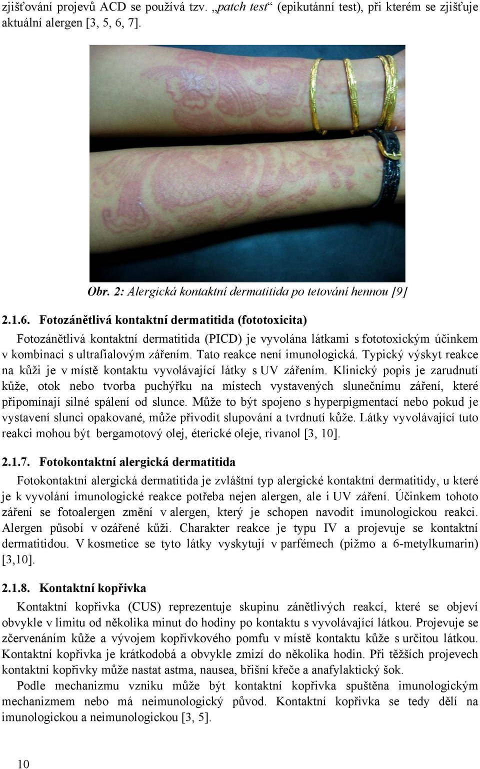 Fotozánětlivá kontaktní dermatitida (fototoxicita) Fotozánětlivá kontaktní dermatitida (PICD) je vyvolána látkami s fototoxickým účinkem v kombinaci s ultrafialovým zářením.