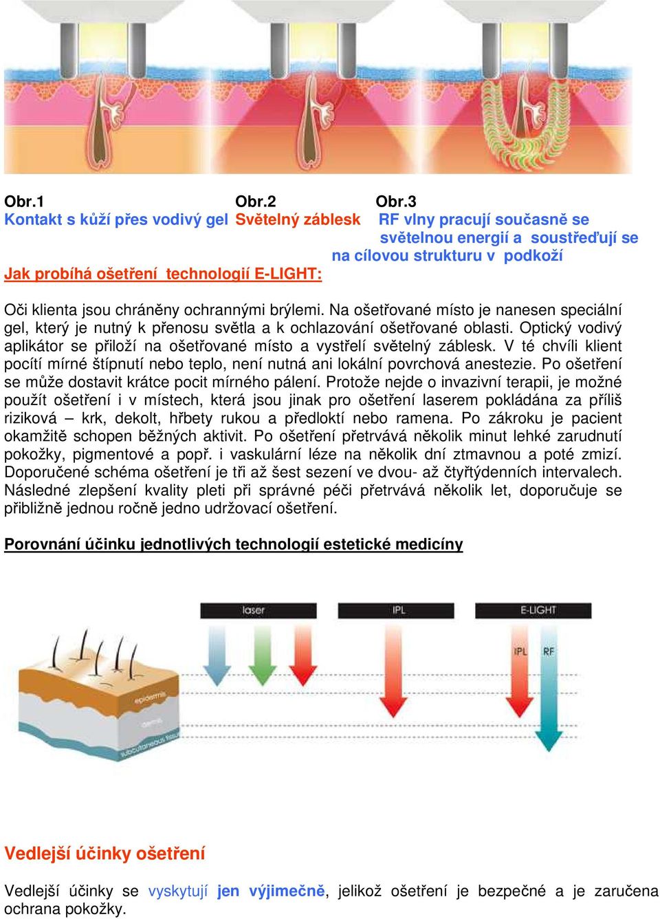 jsou chráněny ochrannými brýlemi. Na ošetřované místo je nanesen speciální gel, který je nutný k přenosu světla a k ochlazování ošetřované oblasti.
