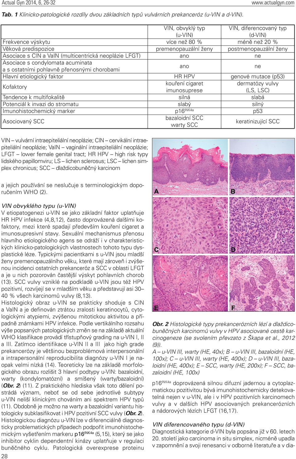 Kofaktory Tendence k multifokalitě Potenciál k invazi do stromatu Imunohistochemický marker Asociovaný SCC VIN, obvyklý typ (u-vin) více než 80 % premenopauzální ženy ano VIN, diferencovaný typ