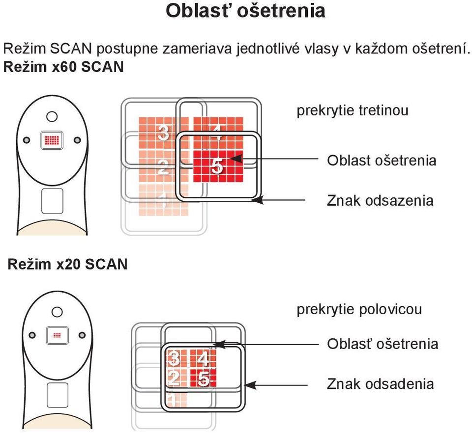 Režim x60 SCAN prekrytie tretinou Oblast ošetrenia