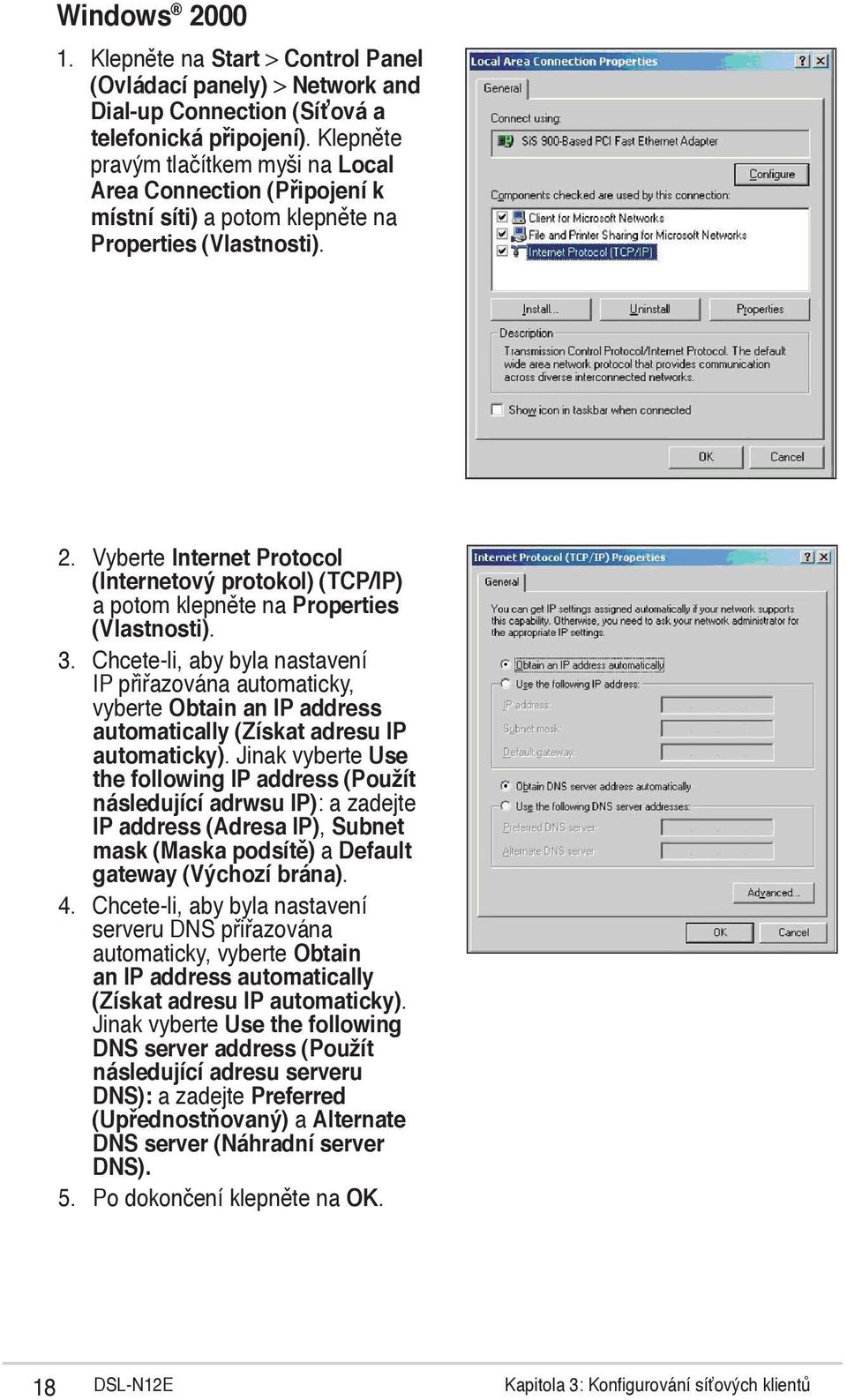 Vyberte Internet Protocol (Internetový protokol) (TCP/IP) a potom klepněte na Properties (Vlastnosti). 3.