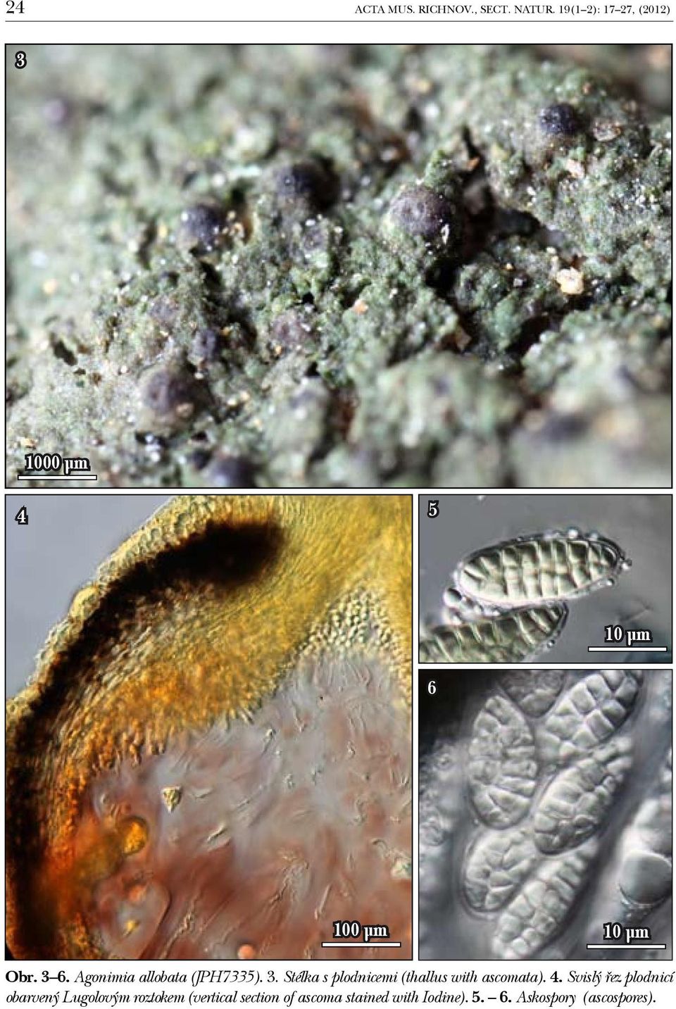 Agonimia allobata (JPH7335). 3. Stélka s plodnicemi (thallus with ascomata).