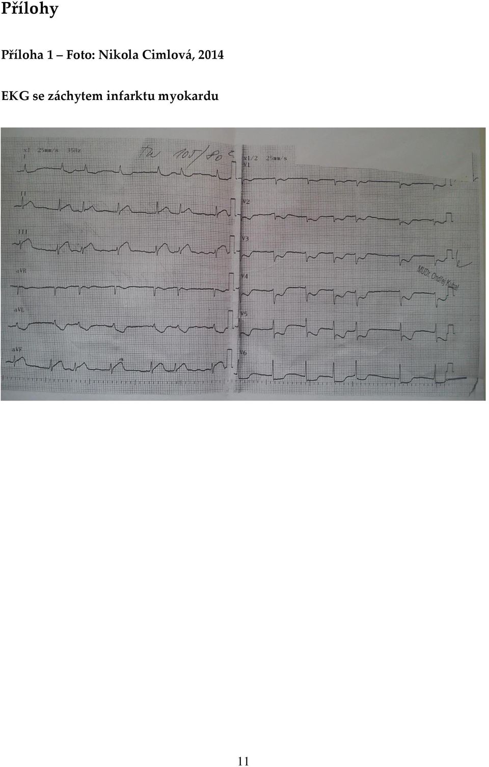 Cimlová, 2014 EKG se