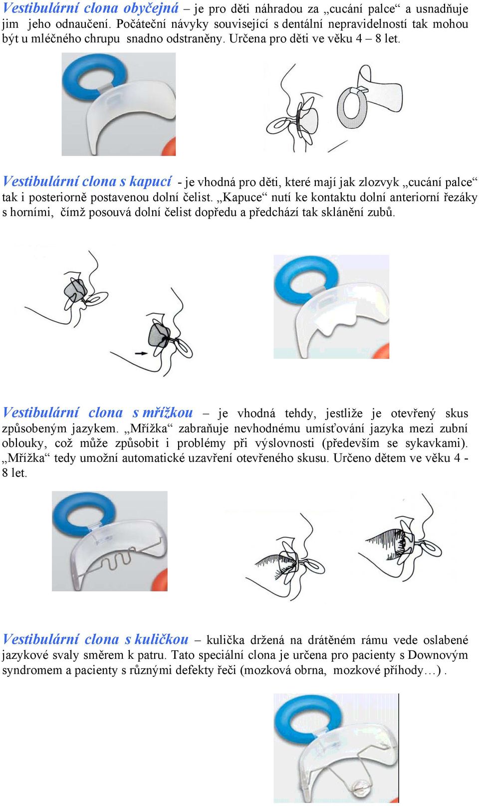 Vestibulární clona s kapucí - je vhodná pro děti, které mají jak zlozvyk cucání palce tak i posteriorně postavenou dolní čelist.