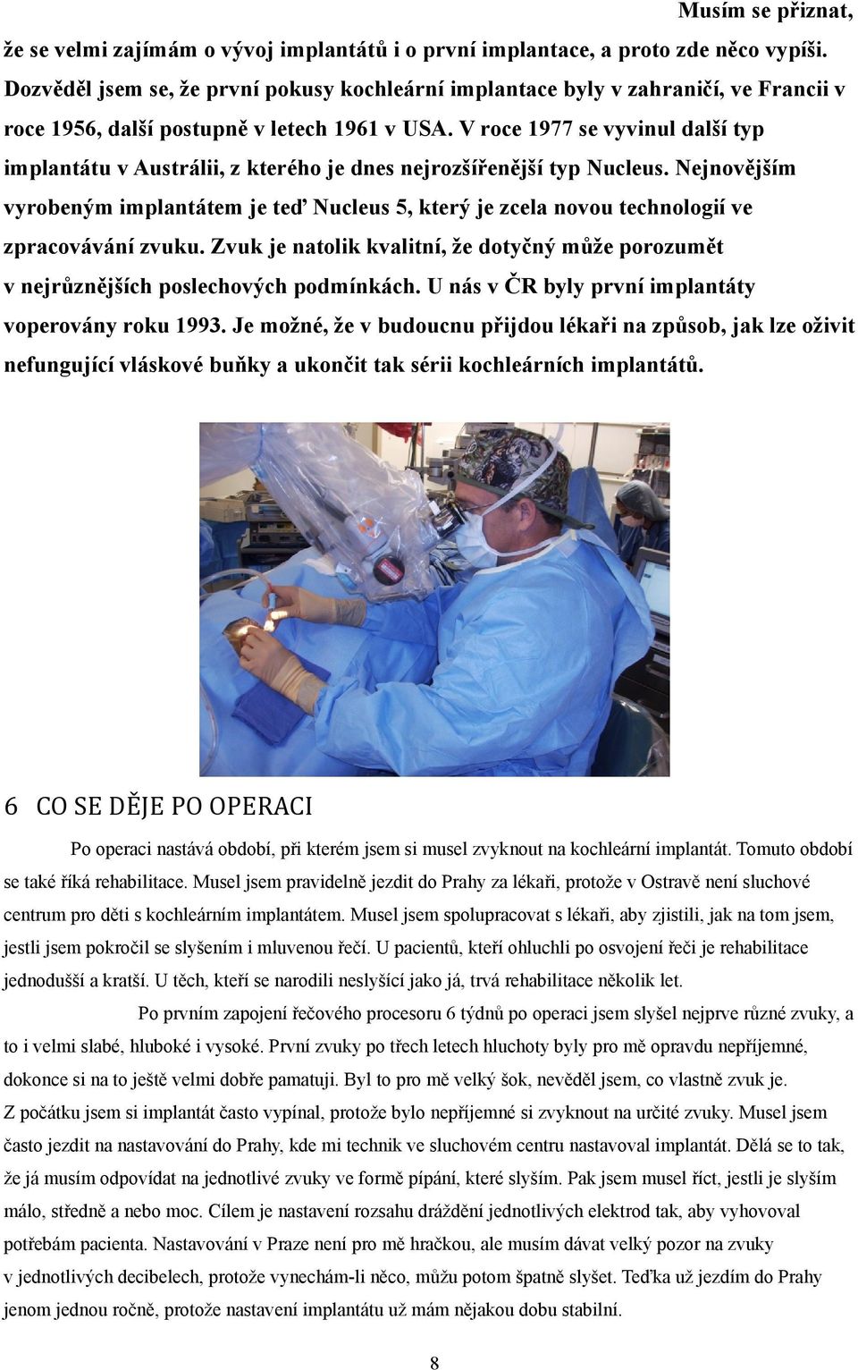 V roce 1977 se vyvinul další typ implantátu v Austrálii, z kterého je dnes nejrozšířenější typ Nucleus.