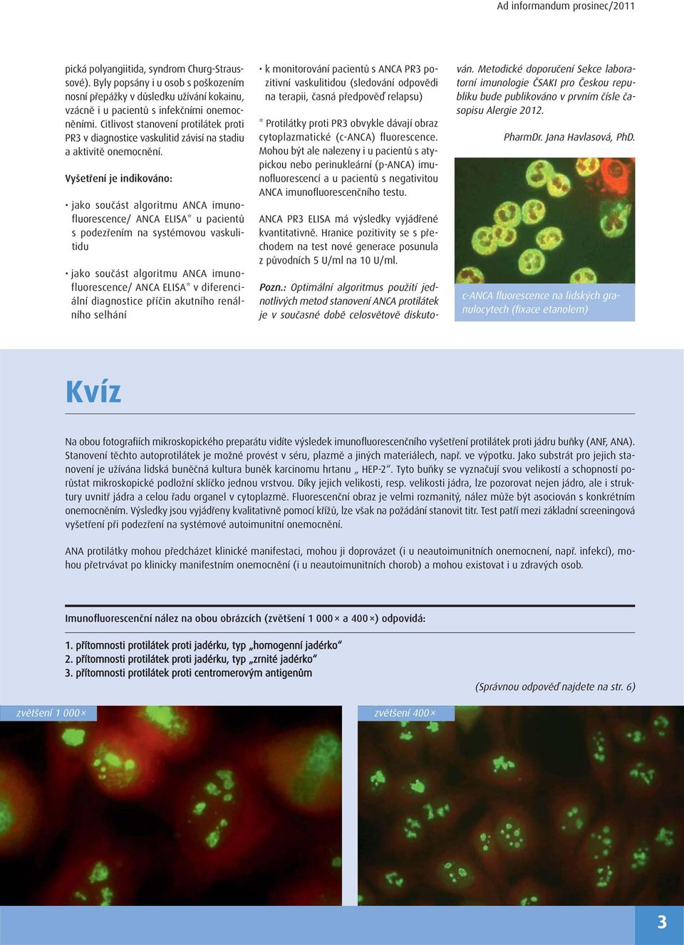 Vyšetření je indikováno: jako součást algoritmu ANCA imunofluorescence/ ANCA ELISA* u pacientů s podezřením na systémovou vaskulitidu jako součást algoritmu ANCA imunofluorescence/ ANCA ELISA* v