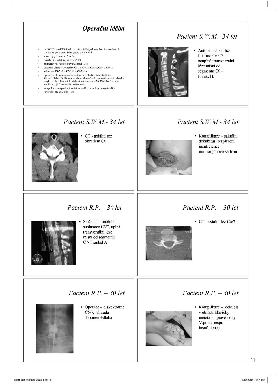 k hospitalizovaných byl 39 let poran ní páte e zlomeniny C3-1x, C4-2x, C-3x, C6-4x, C7-1x, subluxace C4/ 2x, C/6 3x, C6/7 3x operace 11x somatektomie- intersomatická fúze trikortikálním št pem+dlaha