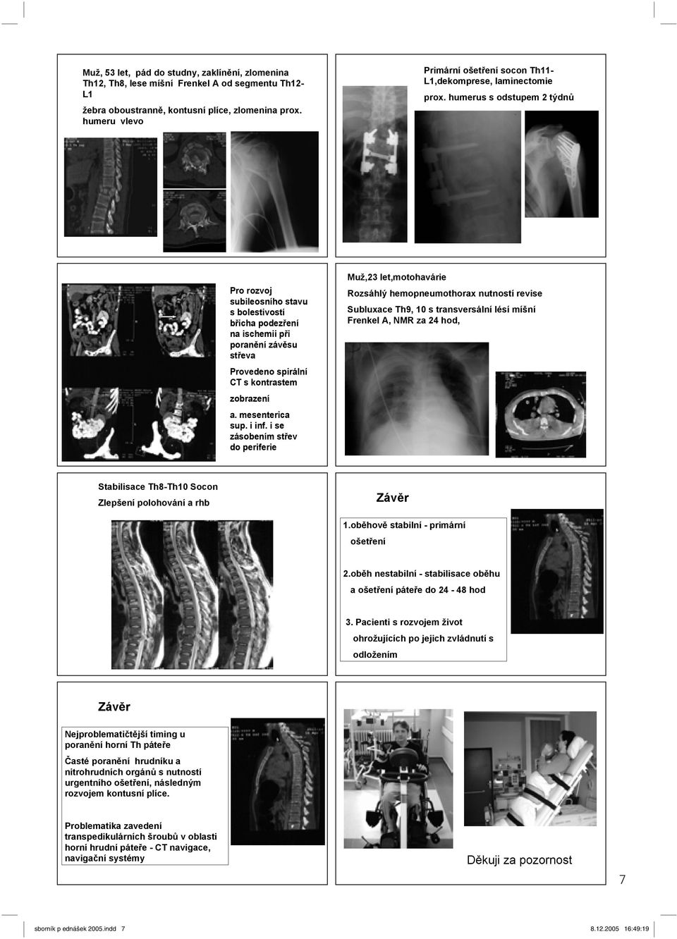 humerus s odstupem 2 týdn Pro rozvoj subileosního stavu s bolestivostí b icha podez ení na ischemii p i poran ní záv su st eva Provedeno spirální CT s kontrastem zobrazení a. mesenterica sup. i inf.