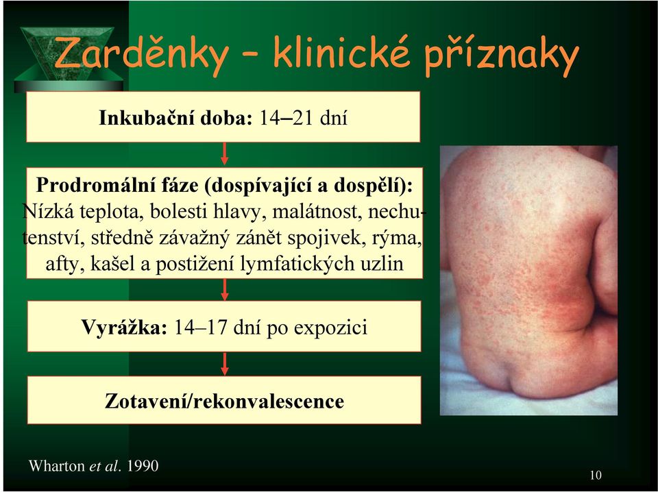 nechutenství, středně závažný zánět spojivek, rýma, afty, kašel a postižení