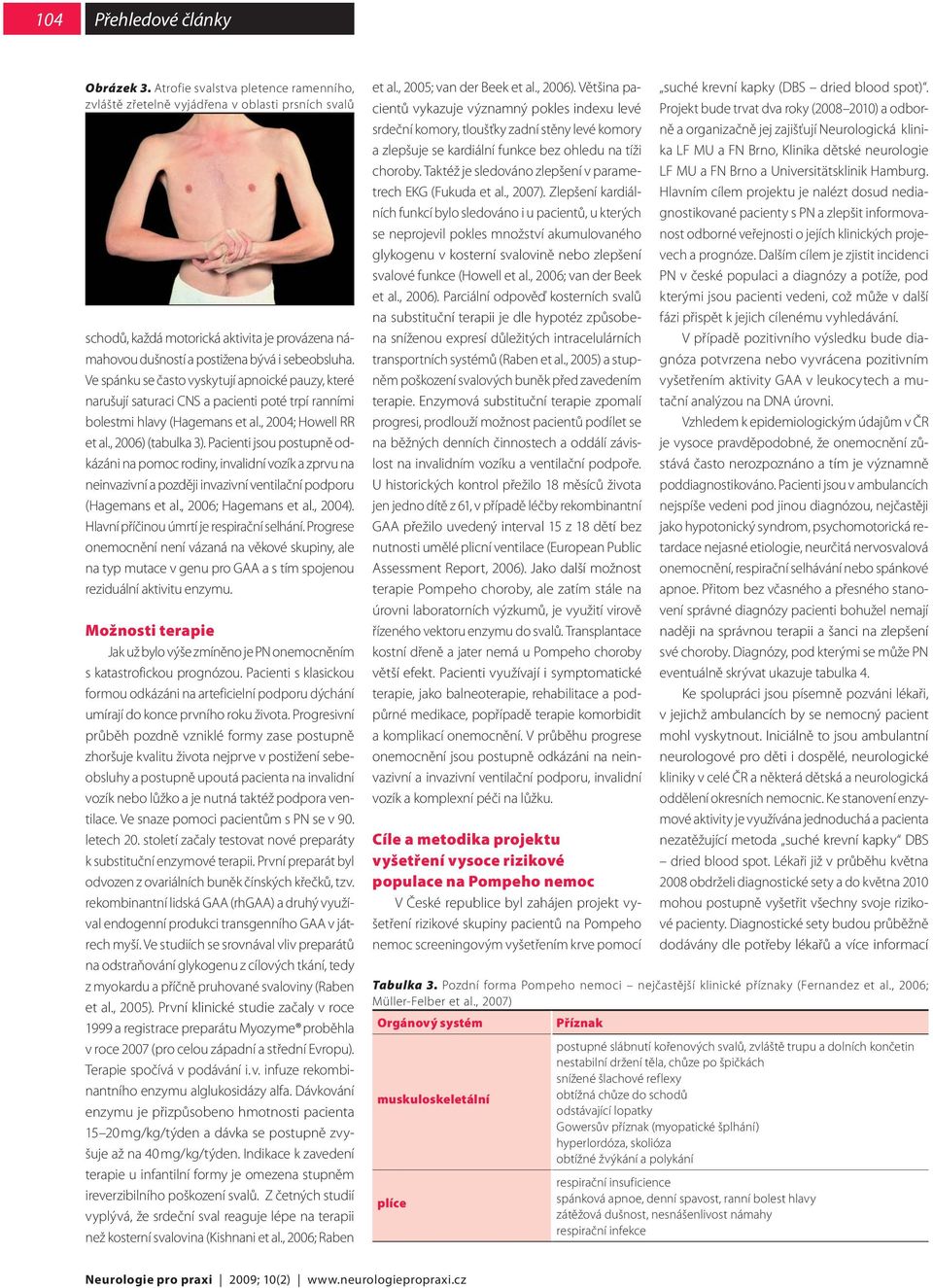 Pacienti jsou postupně odkázáni na pomoc rodiny, invalidní vozík a zprvu na neinvazivní a později invazivní ventilační podporu (Hagemans et al., 2006; Hagemans et al., 2004).